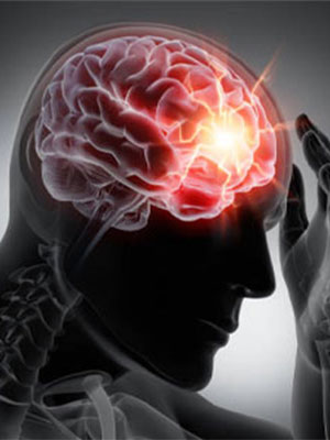 brain stroke treatment Secunderabad